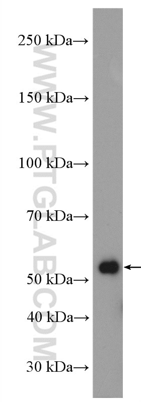 Western Blot (WB) analysis of mouse brain tissue using Carboxypeptidase E Polyclonal antibody (13710-1-AP)