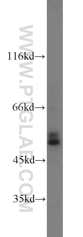 Carboxypeptidase E Polyclonal antibody