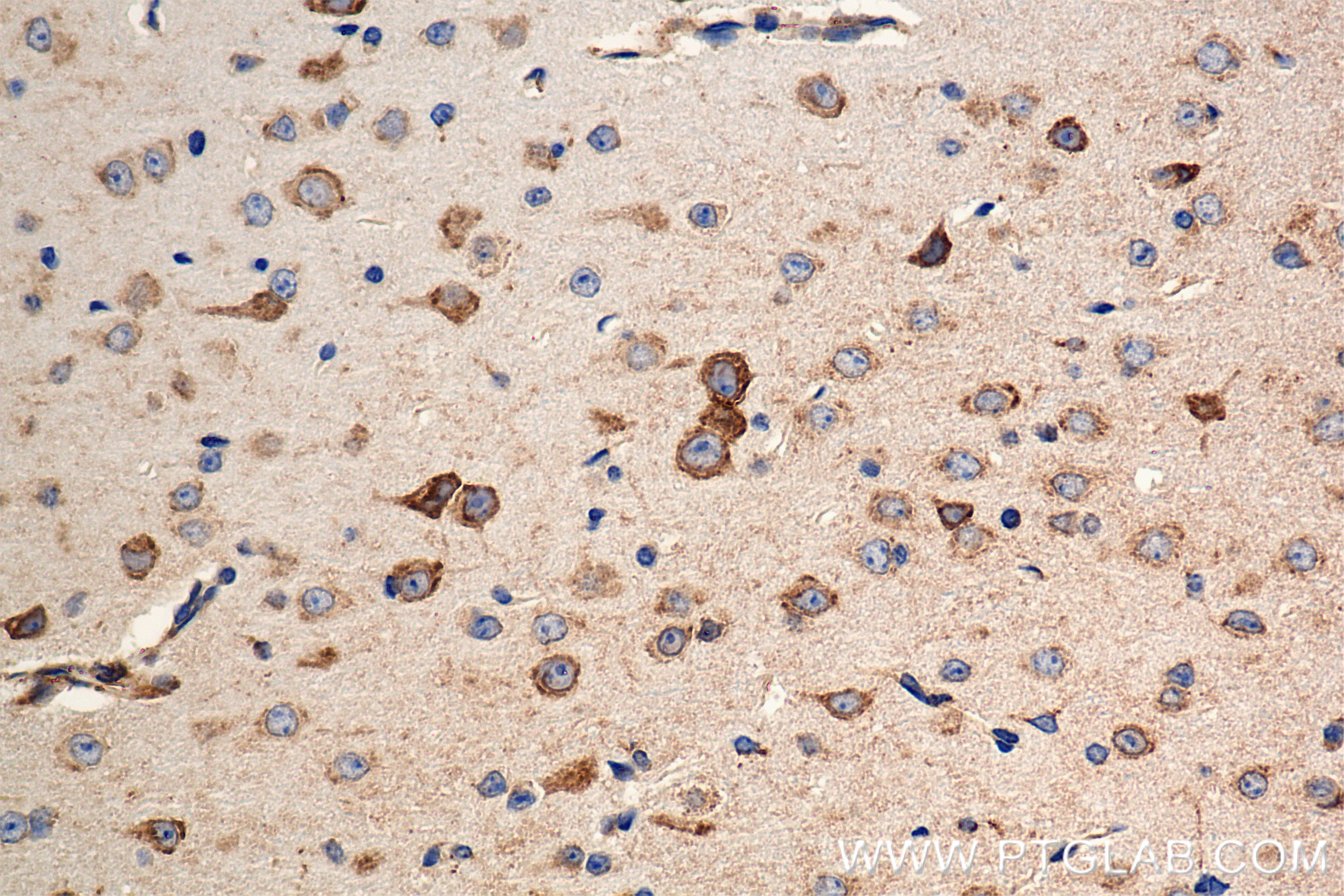 Immunohistochemistry (IHC) staining of mouse brain tissue using CPE Recombinant antibody (86111-1-RR)