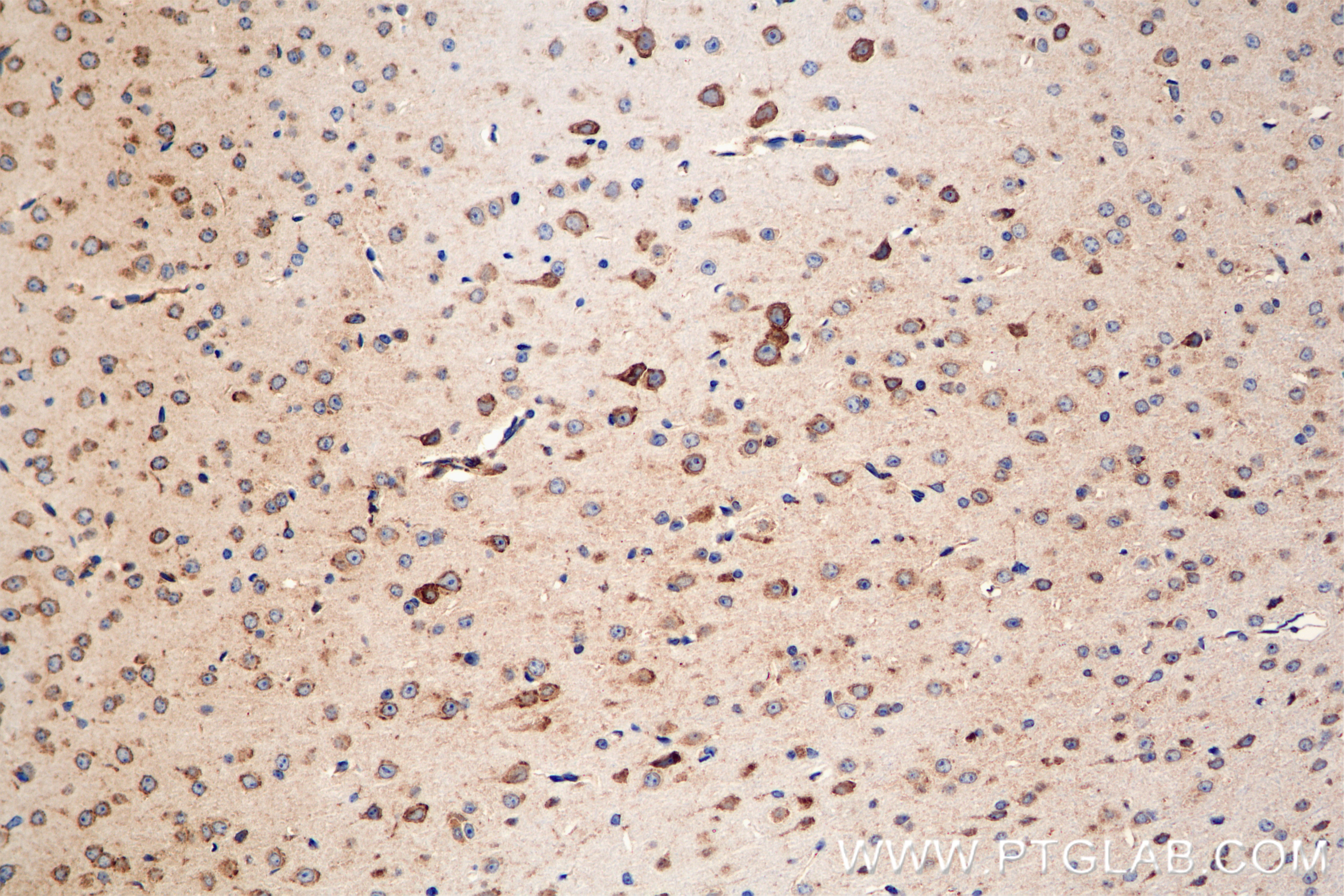 Immunohistochemistry (IHC) staining of mouse brain tissue using CPE Recombinant antibody (86111-1-RR)