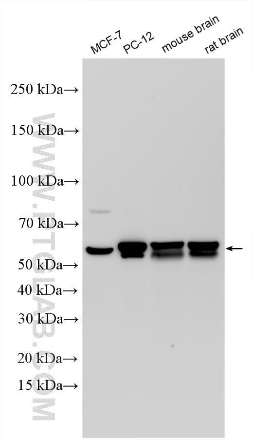 WB analysis using RMX00074 Western Blot (WB) analysis of various lysates using Multi-rAb® CPE Multi-Recombinant antibody (RMX00074)