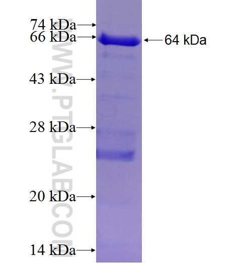 CPE fusion protein Ag4647 SDS-PAGE