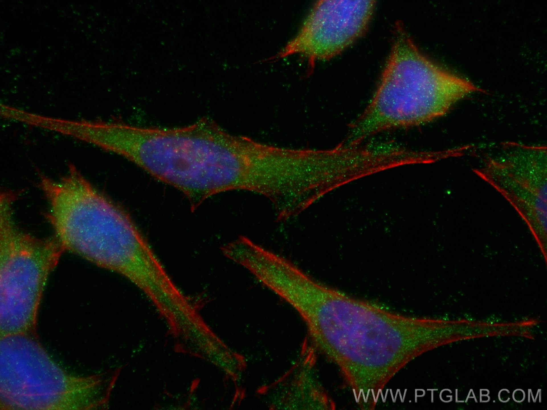 Immunofluorescence (IF) / fluorescent staining of HeLa cells using CPEB1 Polyclonal antibody (13274-1-AP)