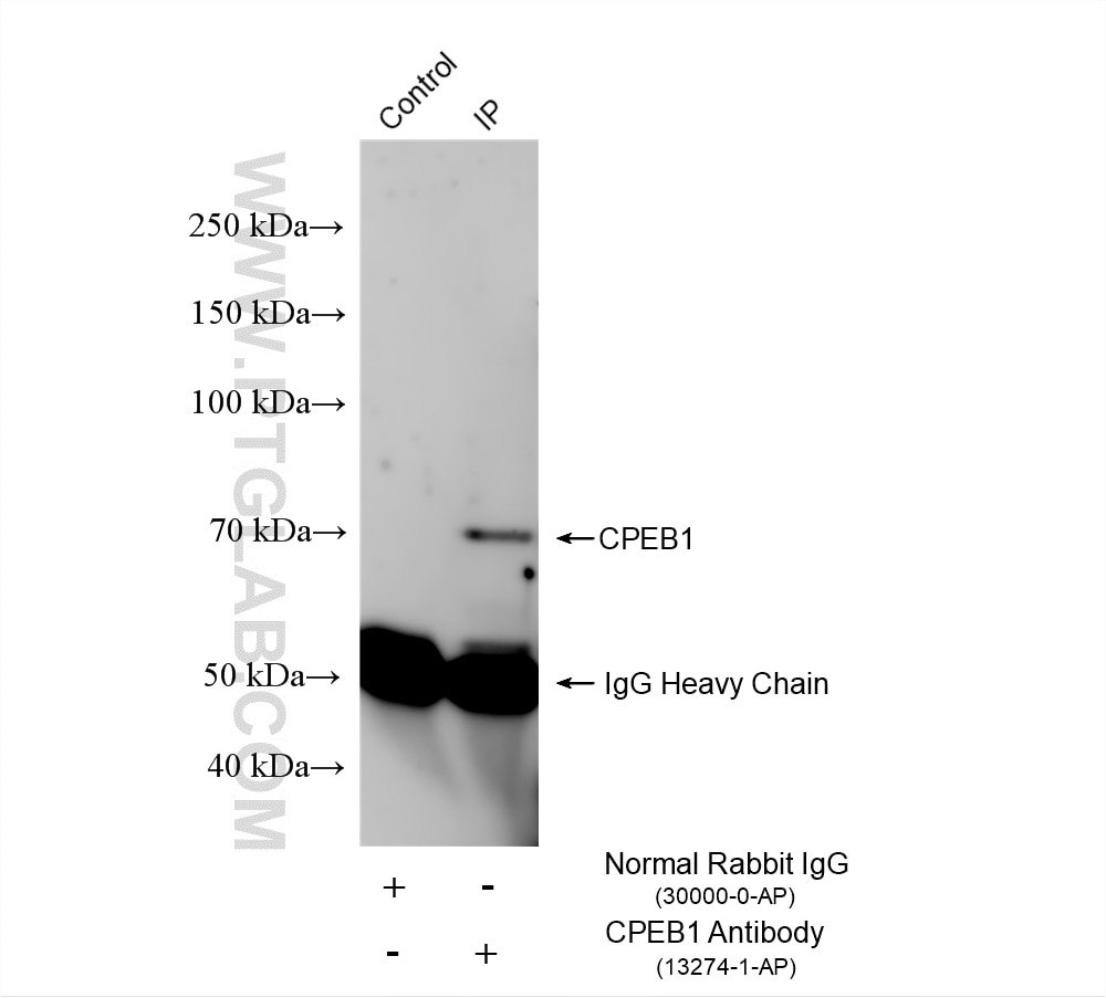Immunoprecipitation (IP) experiment of Neuro-2a cells using CPEB1 Polyclonal antibody (13274-1-AP)