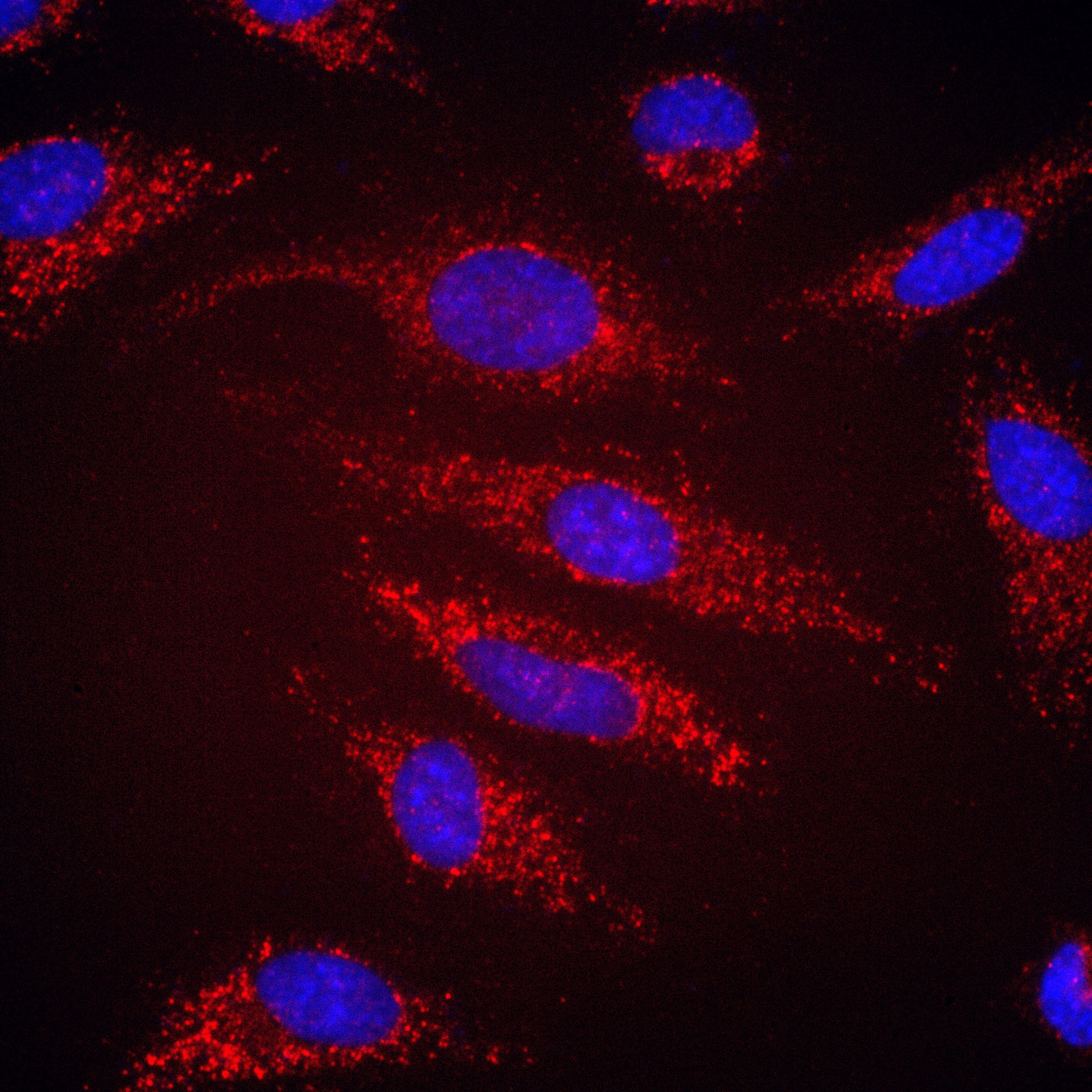 Immunofluorescence (IF) / fluorescent staining of HeLa cells using CPEB1 Recombinant antibody (82785-1-RR)