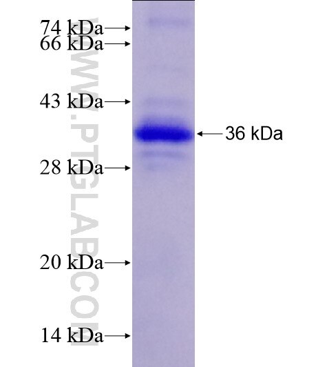 CPEB1 fusion protein Ag28656 SDS-PAGE