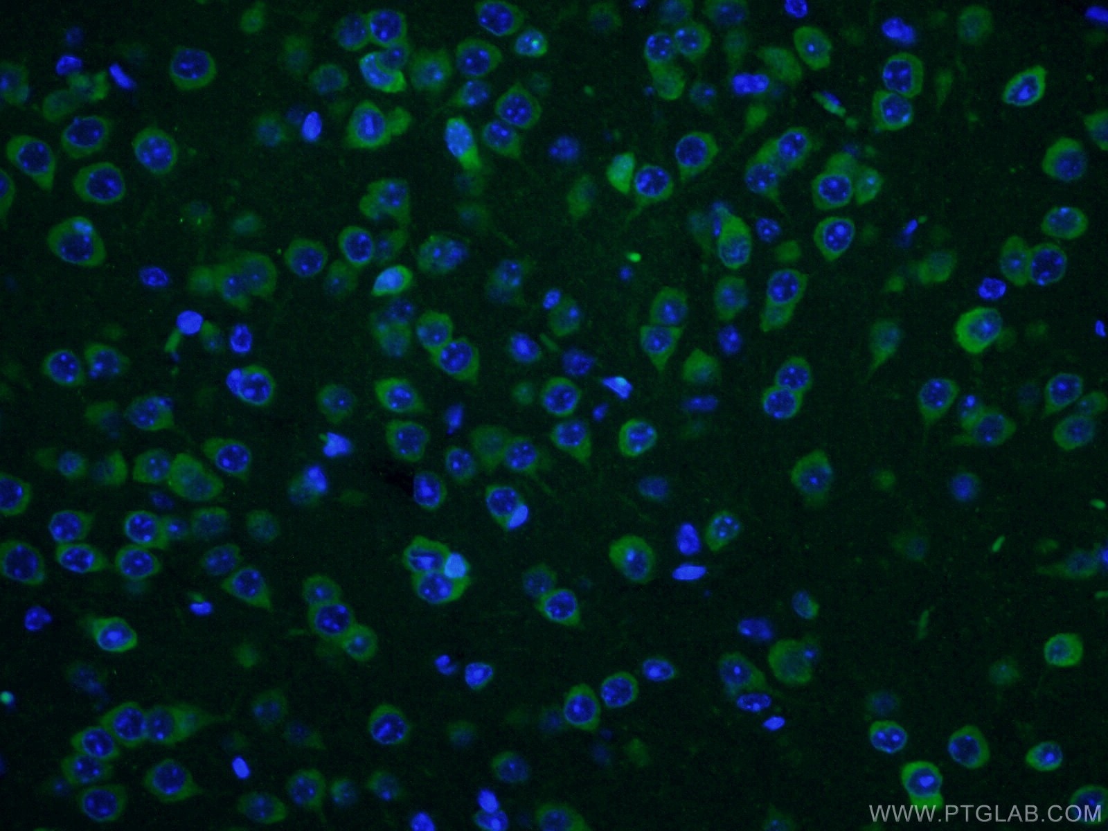 IF Staining of mouse brain using 12669-1-AP
