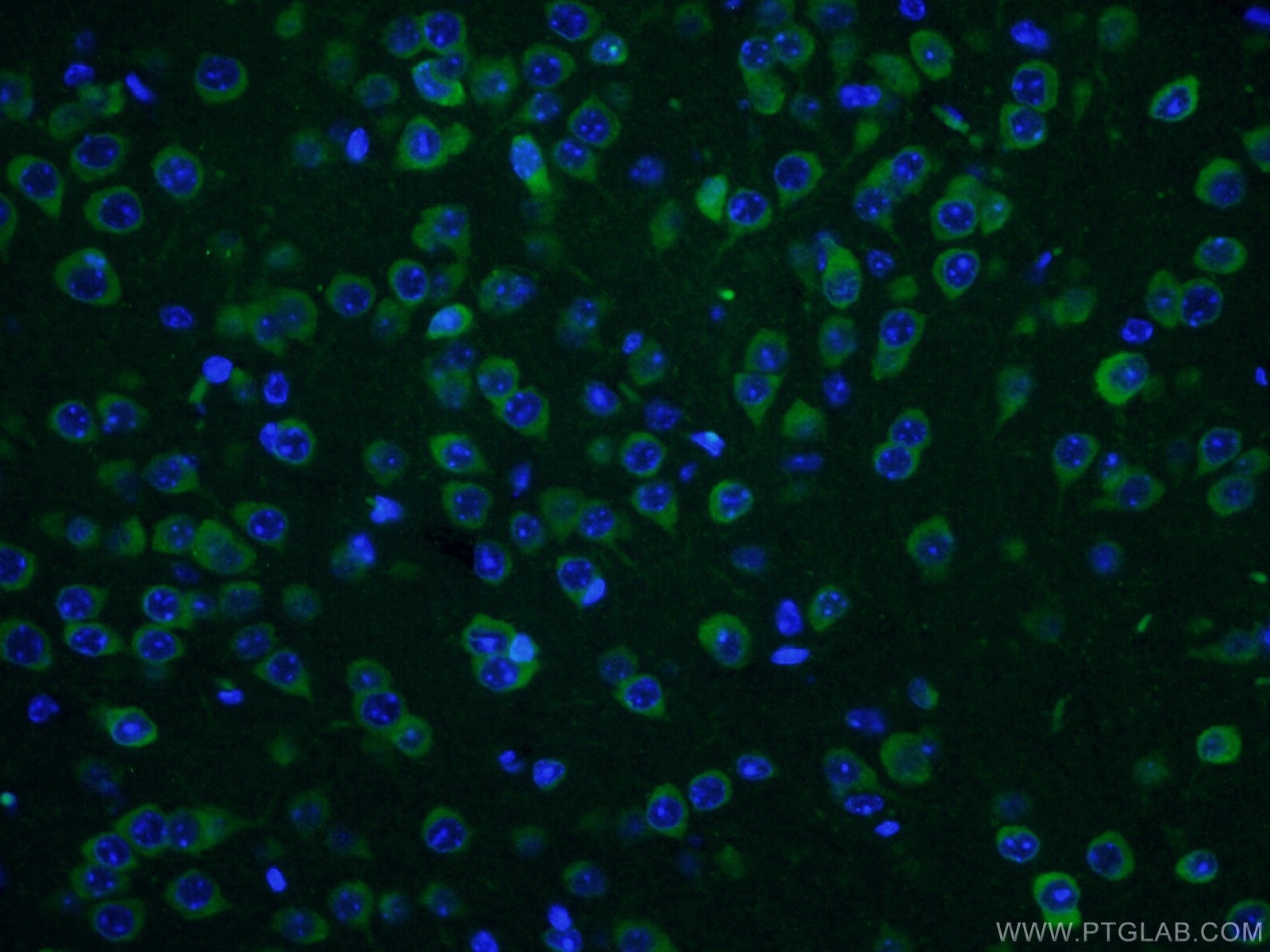 Immunofluorescence (IF) / fluorescent staining of mouse brain tissue using CPEB3 Polyclonal antibody (12669-1-AP)