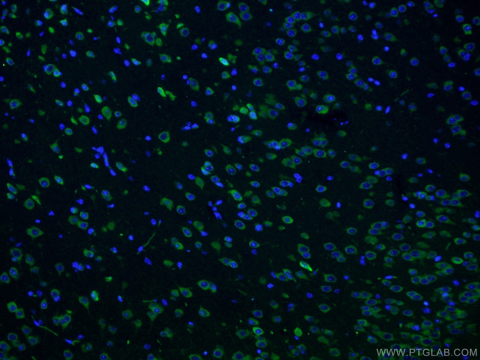 Immunofluorescence (IF) / fluorescent staining of mouse brain tissue using CPEB3 Polyclonal antibody (12669-1-AP)