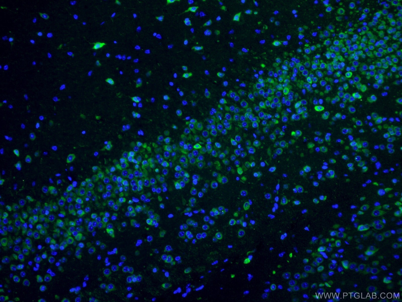 Immunofluorescence (IF) / fluorescent staining of mouse brain tissue using CPEB3 Polyclonal antibody (12669-1-AP)