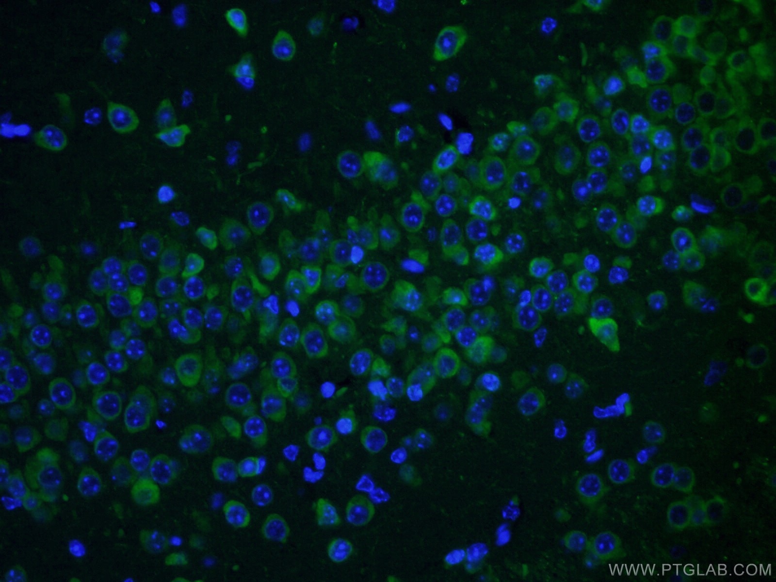 Immunofluorescence (IF) / fluorescent staining of mouse brain tissue using CPEB3 Polyclonal antibody (12669-1-AP)