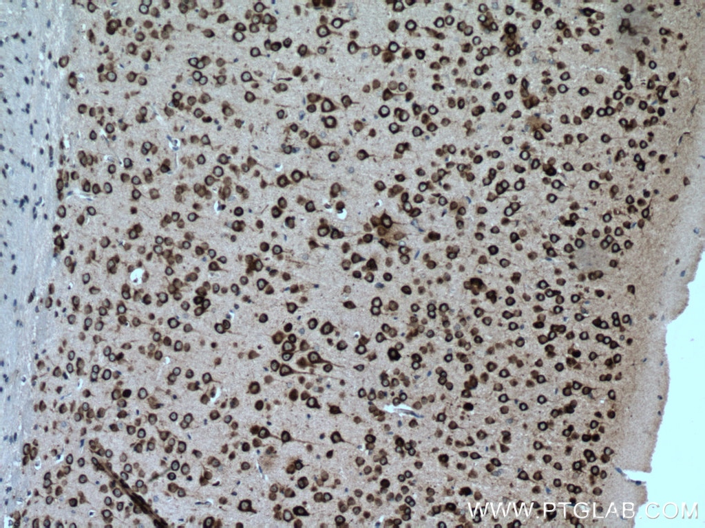 Immunohistochemistry (IHC) staining of mouse brain tissue using CPEB3 Polyclonal antibody (12669-1-AP)