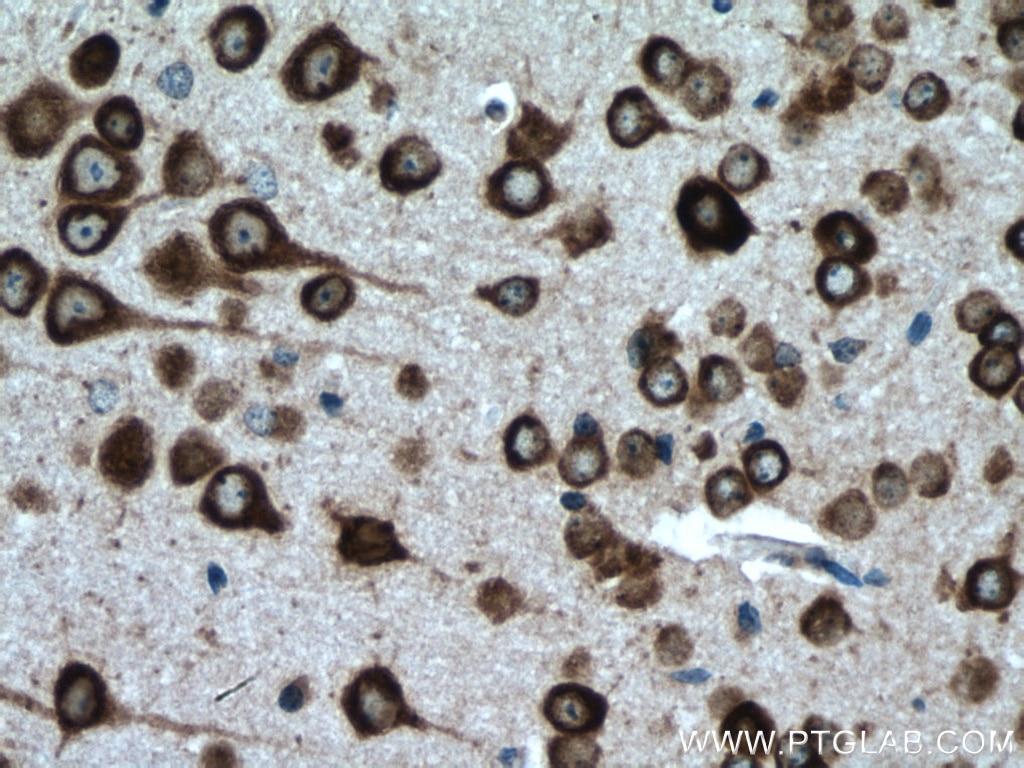 Immunohistochemistry (IHC) staining of mouse brain tissue using CPEB3 Polyclonal antibody (12669-1-AP)