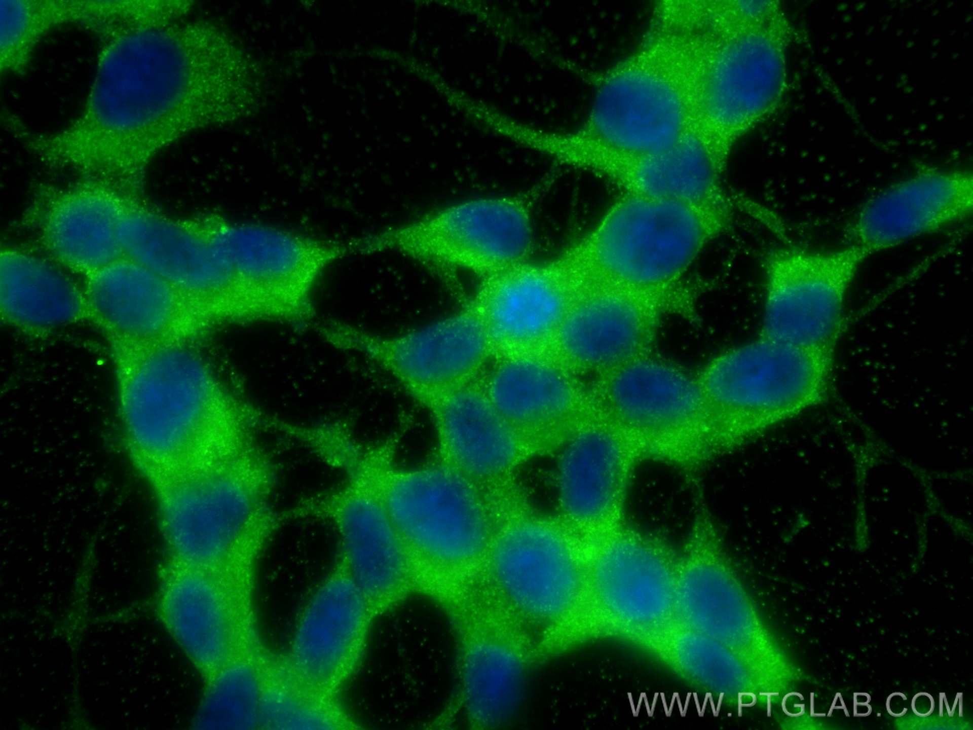 Immunofluorescence (IF) / fluorescent staining of SH-SY5Y cells using CPEB4 Polyclonal antibody (25342-1-AP)