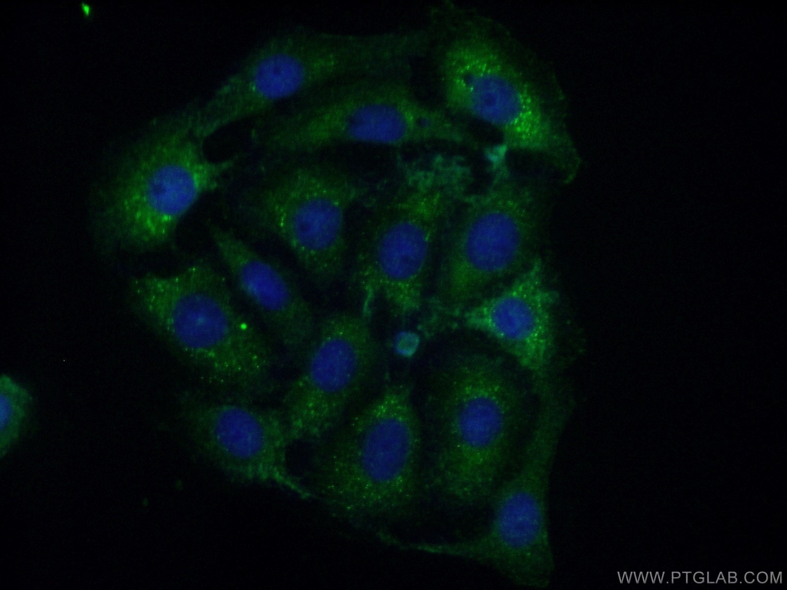 Immunofluorescence (IF) / fluorescent staining of SH-SY5Y cells using CPEB4 Polyclonal antibody (25342-1-AP)