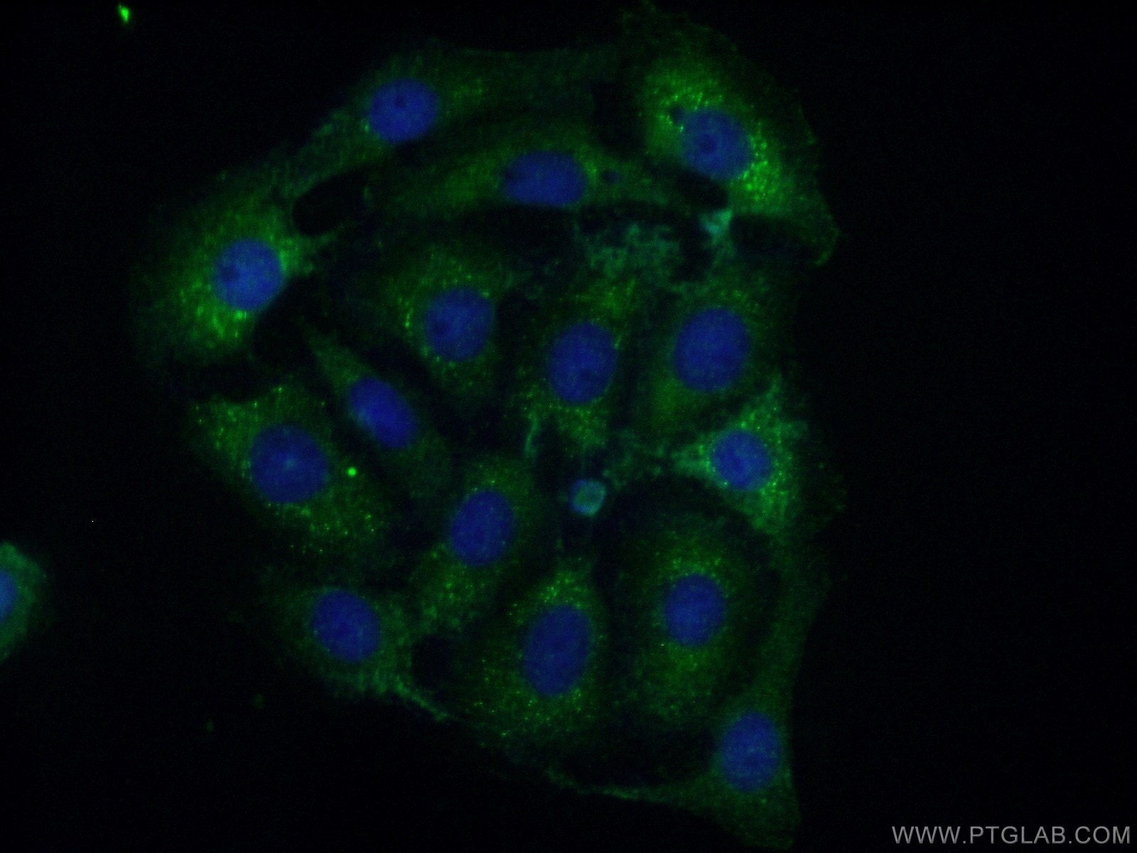 IF Staining of SH-SY5Y using 25342-1-AP