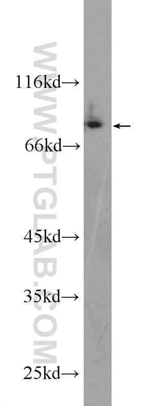 Western Blot (WB) analysis of A375 cells using CPEB4 Polyclonal antibody (25342-1-AP)