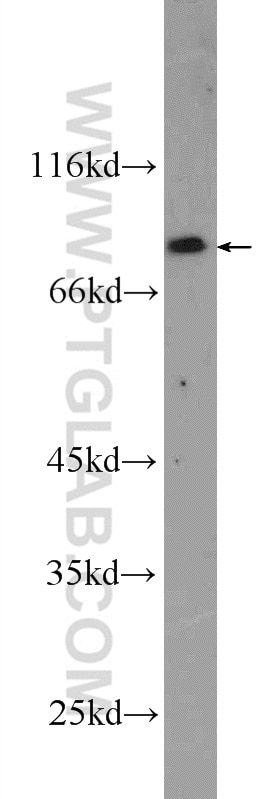 WB analysis of SH-SY5Y using 25342-1-AP