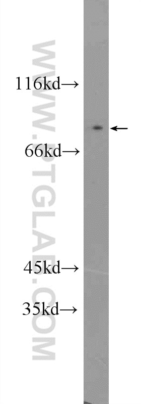 WB analysis of HeLa using 25342-1-AP