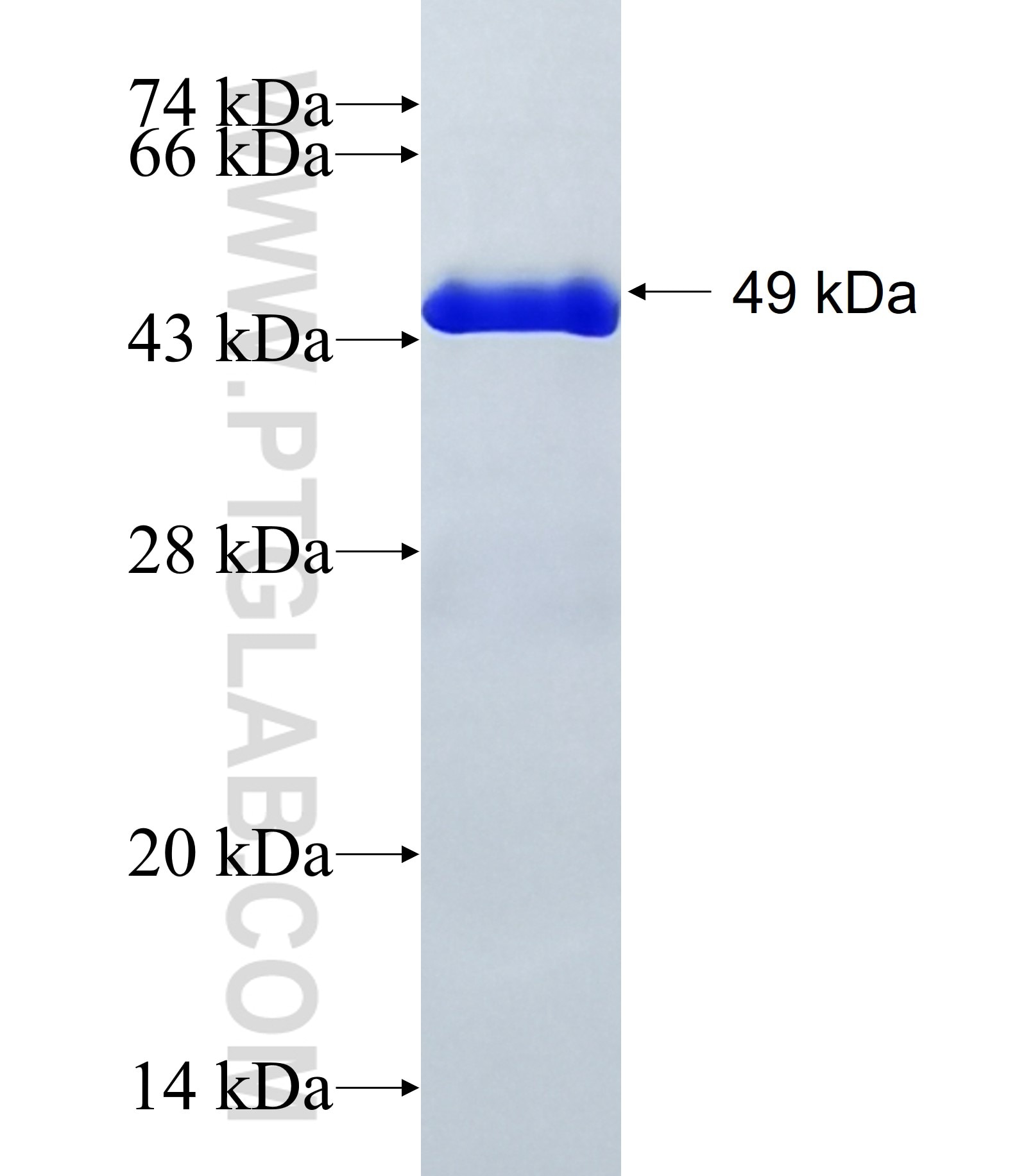 CPEB4 fusion protein Ag39607 SDS-PAGE CPEB4 fusion protein Ag39607 SDS-PAGE
