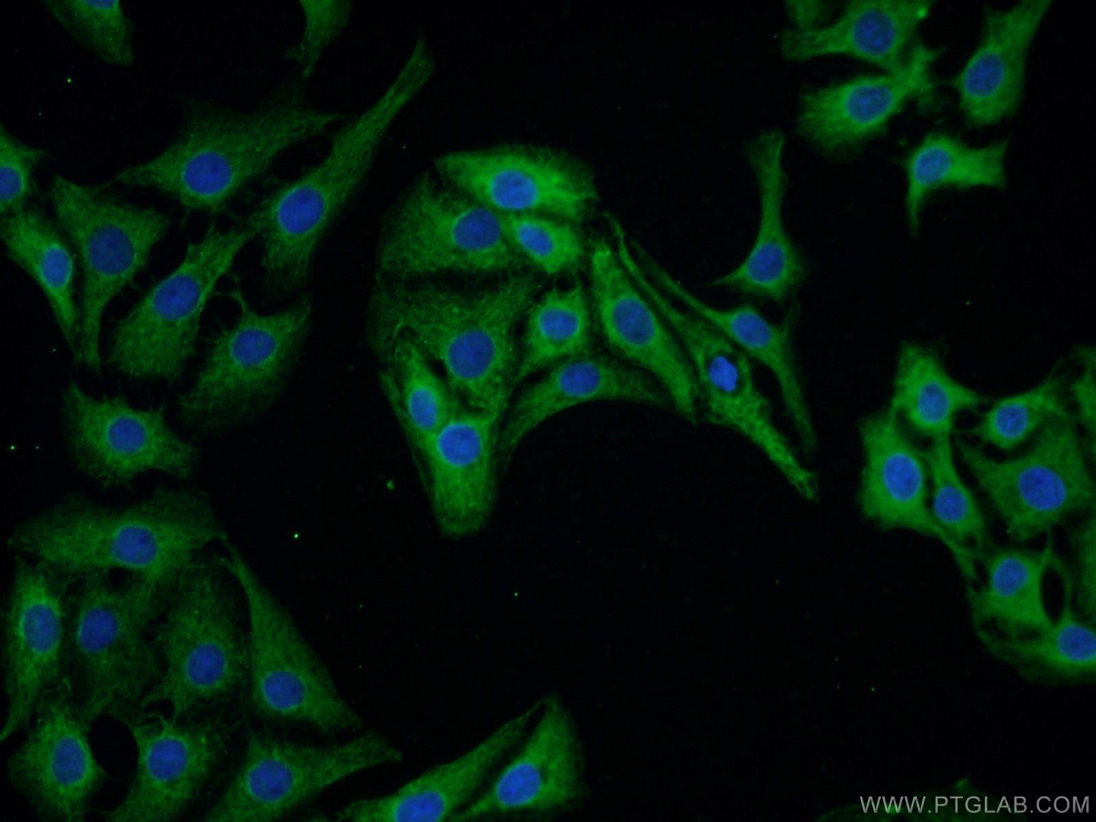 Immunofluorescence (IF) / fluorescent staining of SH-SY5Y cells using CPLX1 Polyclonal antibody (10246-2-AP)