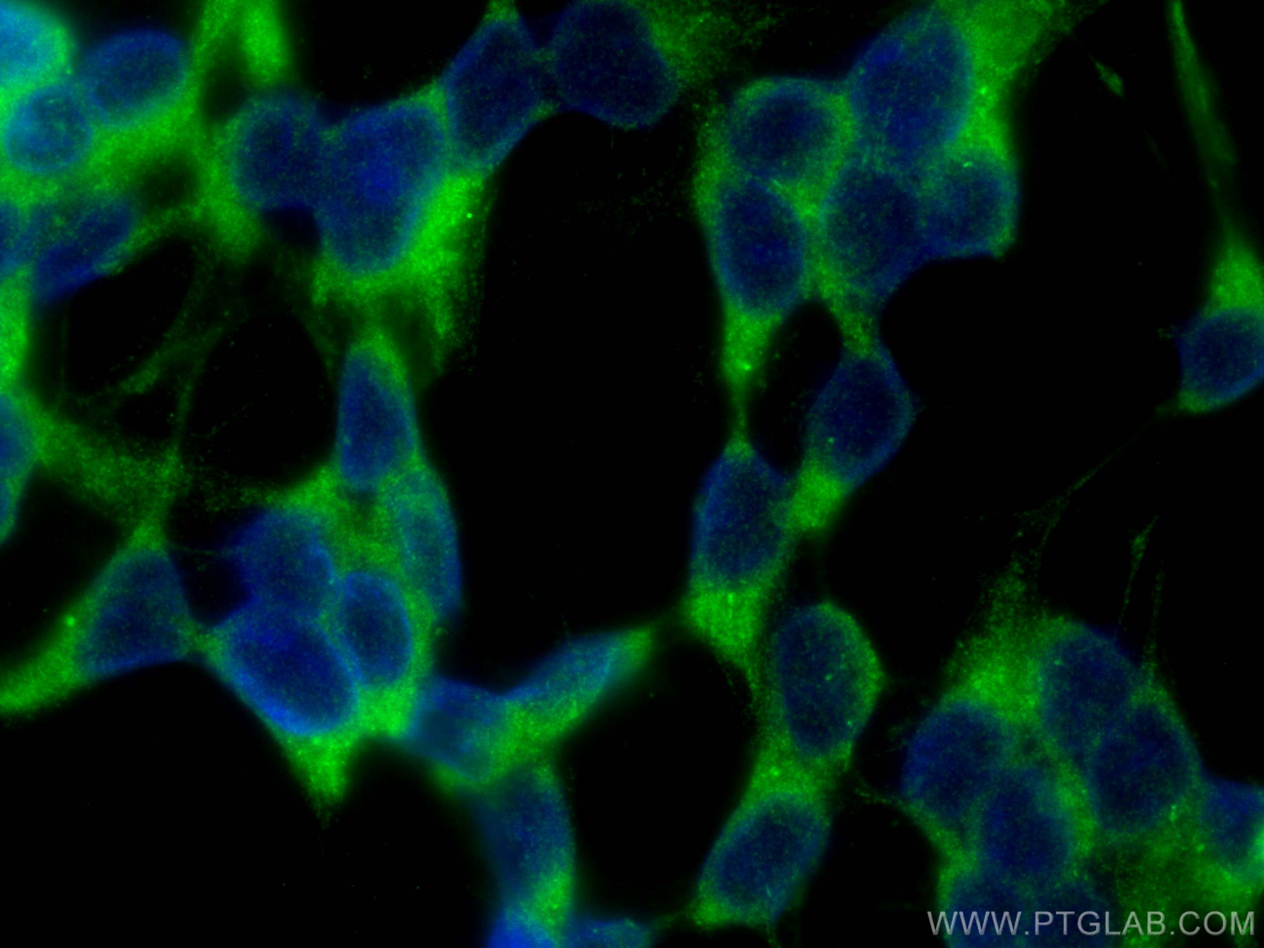 Immunofluorescence (IF) / fluorescent staining of SH-SY5Y cells using CPLX1 Polyclonal antibody (10246-2-AP)