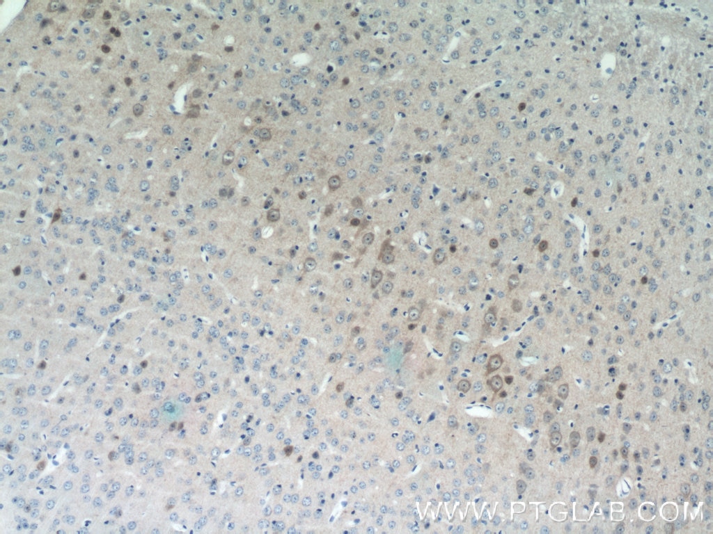 IHC staining of mouse brain using 10246-2-AP