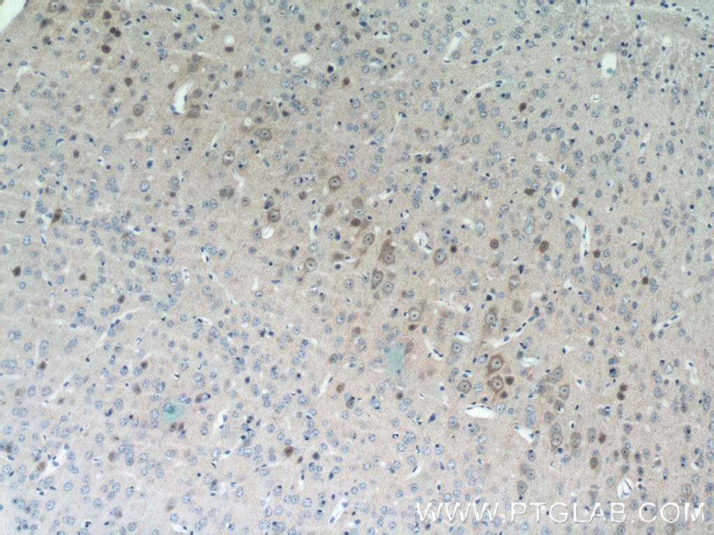 Immunohistochemistry (IHC) staining of mouse brain tissue using CPLX1 Polyclonal antibody (10246-2-AP)