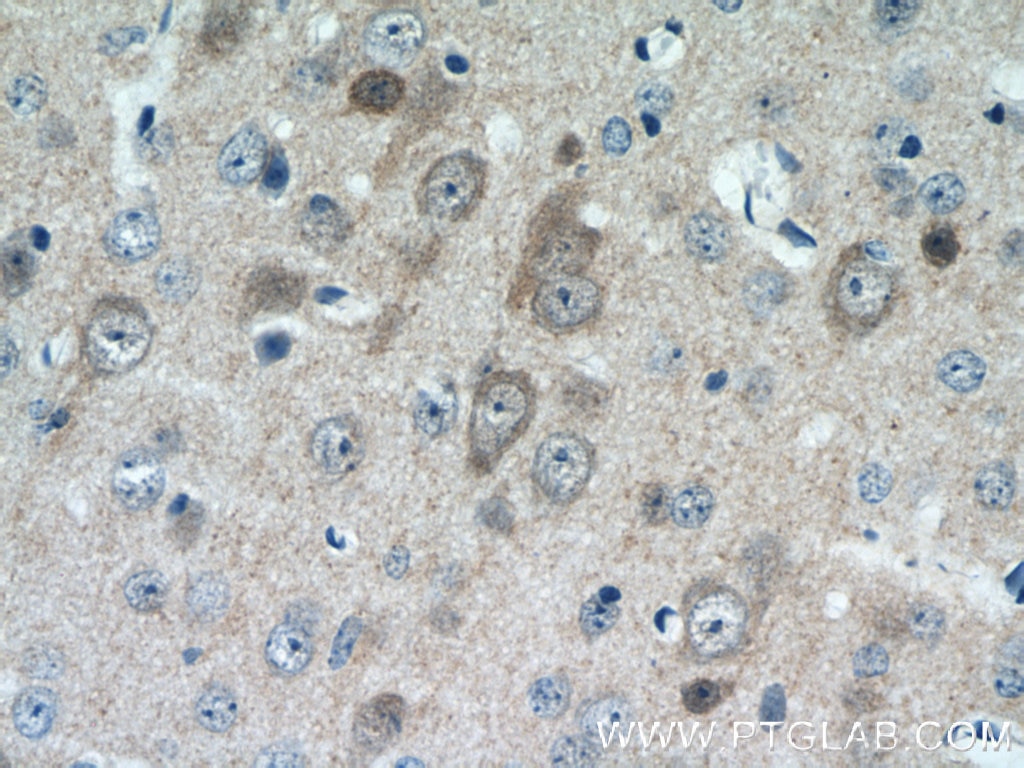 Immunohistochemistry (IHC) staining of mouse brain tissue using CPLX1 Polyclonal antibody (10246-2-AP)