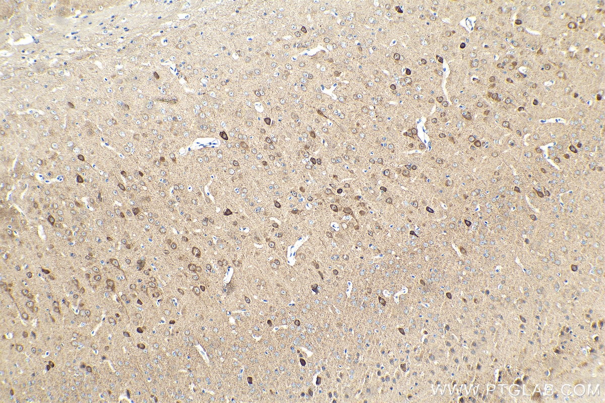 Immunohistochemistry (IHC) staining of mouse brain tissue using CPLX1 Polyclonal antibody (10246-2-AP)