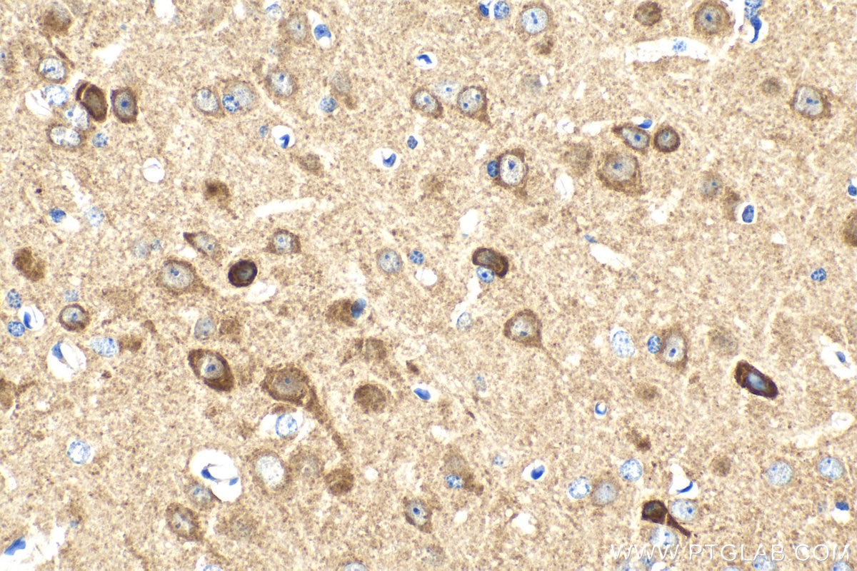 Immunohistochemistry (IHC) staining of mouse brain tissue using CPLX1 Polyclonal antibody (10246-2-AP)