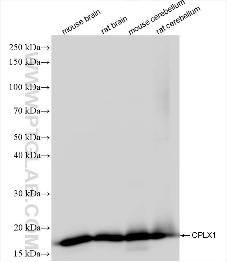 Western Blot (WB) analysis of various lysates using CPLX1 Recombinant antibody (85874-1-RR)