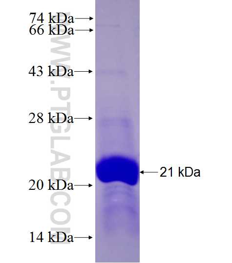 CPLX1 fusion protein Ag27918 SDS-PAGE