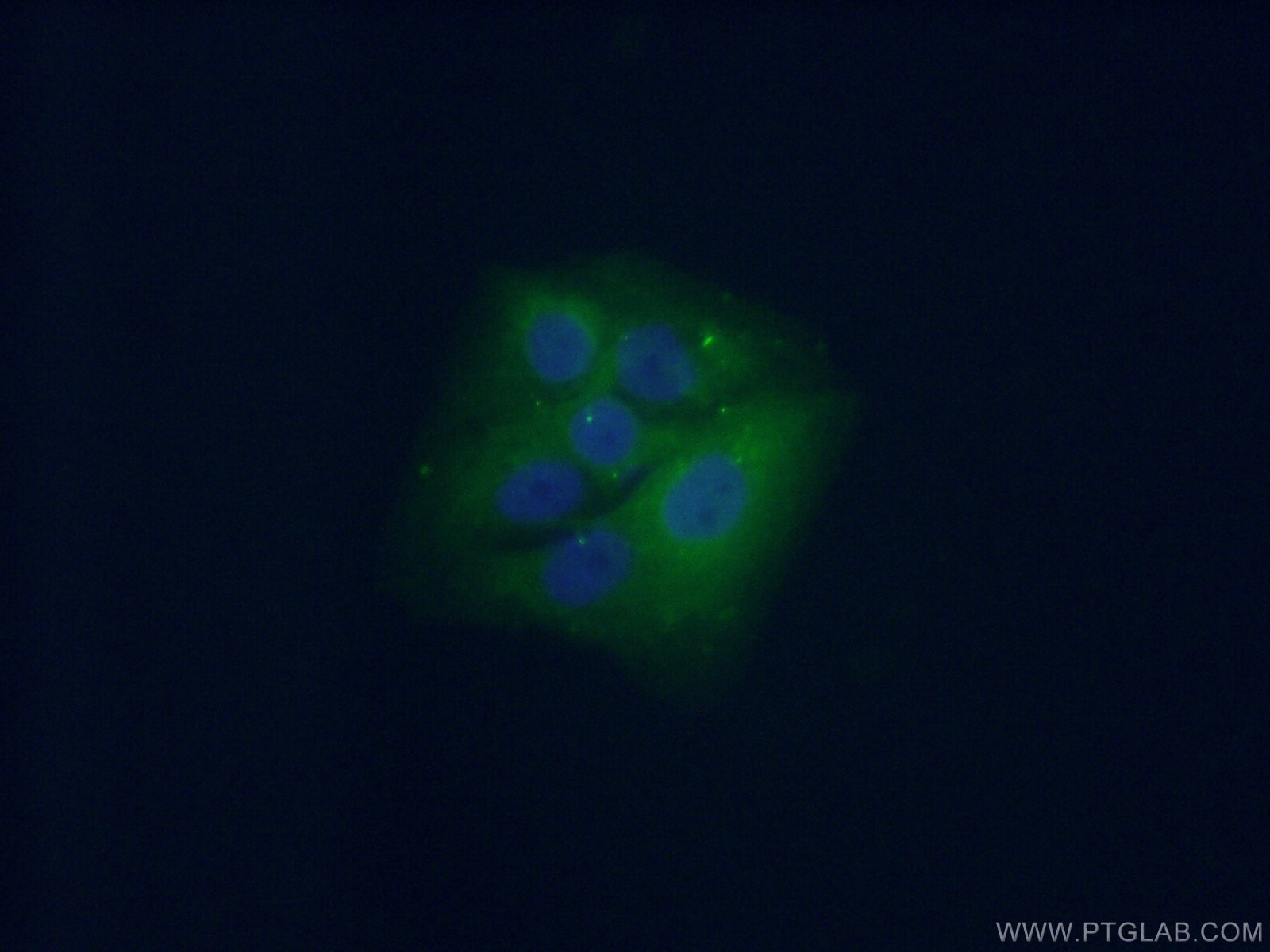 Immunofluorescence (IF) / fluorescent staining of A549 cells using CPLX2 Polyclonal antibody (18149-1-AP)