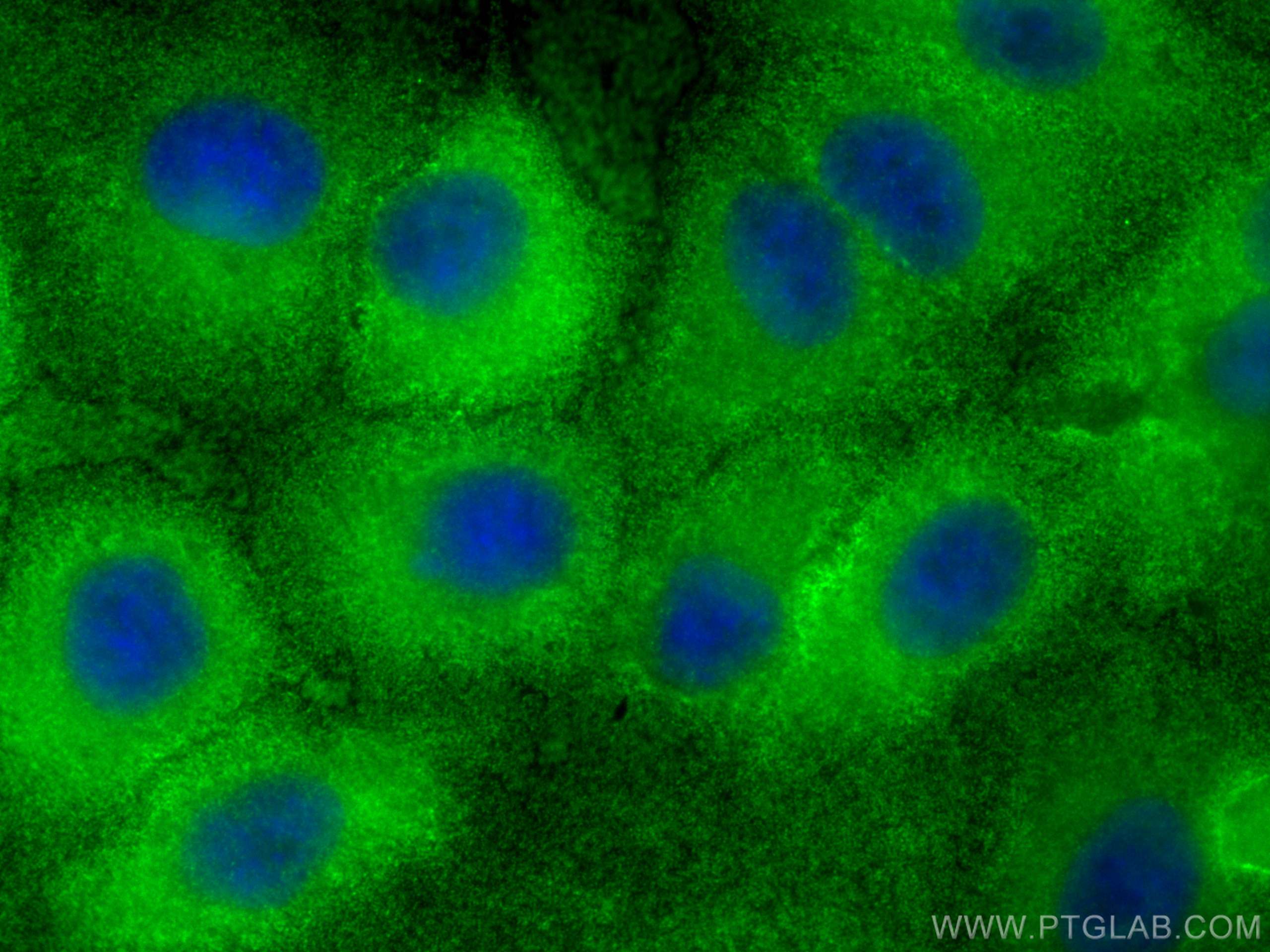 Immunofluorescence (IF) / fluorescent staining of A549 cells using CPLX2 Polyclonal antibody (18149-1-AP)