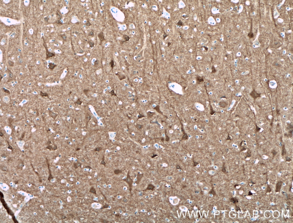 Immunohistochemistry (IHC) staining of human brain tissue using CPLX2 Polyclonal antibody (18149-1-AP)