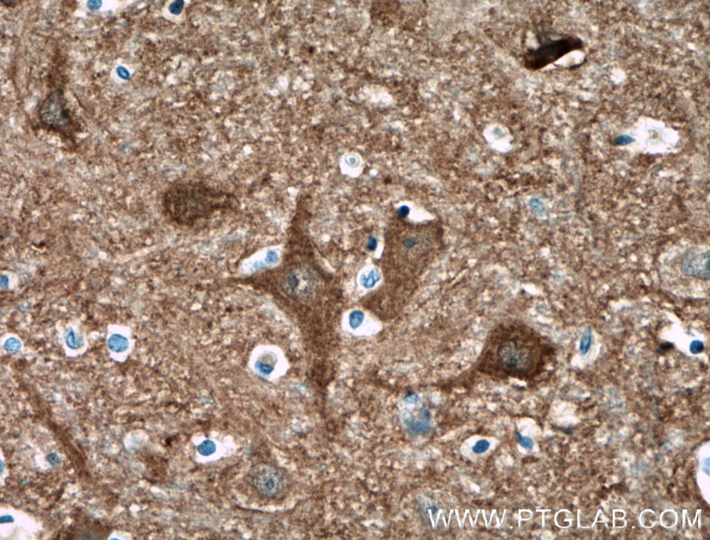 Immunohistochemistry (IHC) staining of human brain tissue using CPLX2 Polyclonal antibody (18149-1-AP)