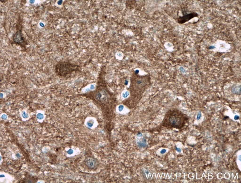 IHC staining of human brain using 18149-1-AP