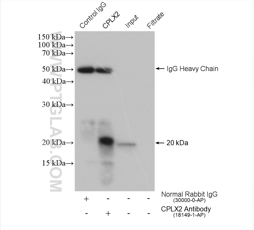 Immunoprecipitation (IP) experiment of A549 cells using CPLX2 Polyclonal antibody (18149-1-AP)