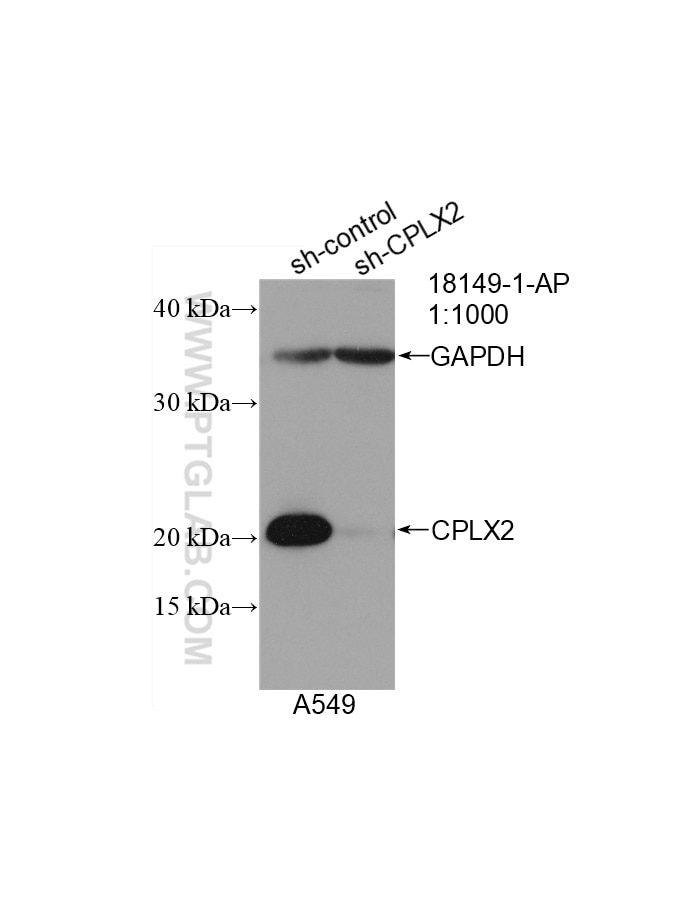 Western Blot (WB) analysis of A549 cells using CPLX2 Polyclonal antibody (18149-1-AP)