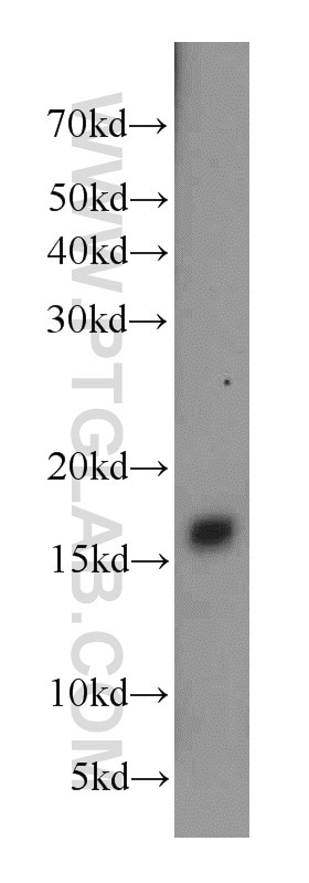 CPLX2 Polyclonal antibody