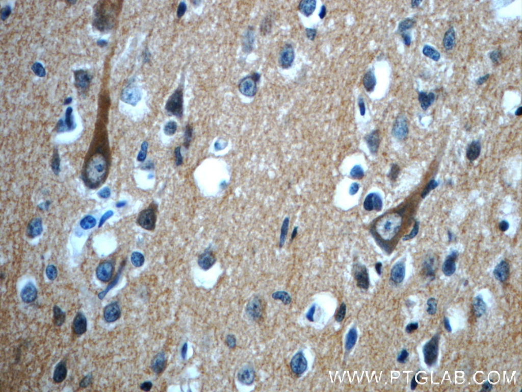 Immunohistochemistry (IHC) staining of human brain tissue using CPLX2 Polyclonal antibody (20249-1-AP)