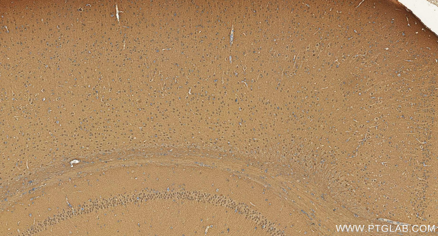 Immunohistochemistry (IHC) staining of mouse brain tissue using CPLX2 Polyclonal antibody (20249-1-AP)
