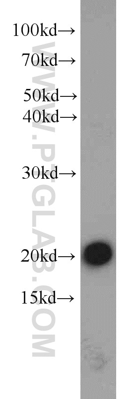 Western Blot (WB) analysis of mouse brain tissue using CPLX2 Polyclonal antibody (20249-1-AP)