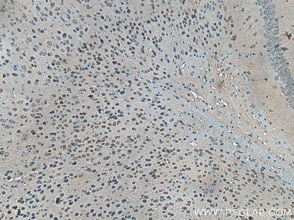 IHC staining of mouse brain using 66849-1-Ig