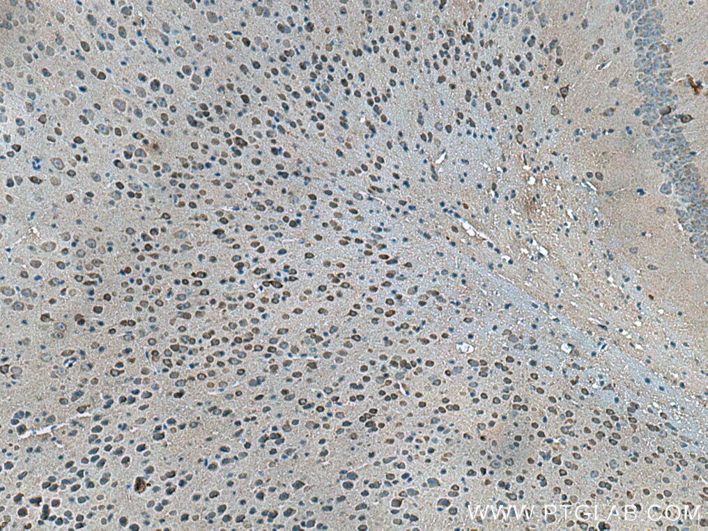 Immunohistochemistry (IHC) staining of mouse brain tissue using CPLX2 Monoclonal antibody (66849-1-Ig)