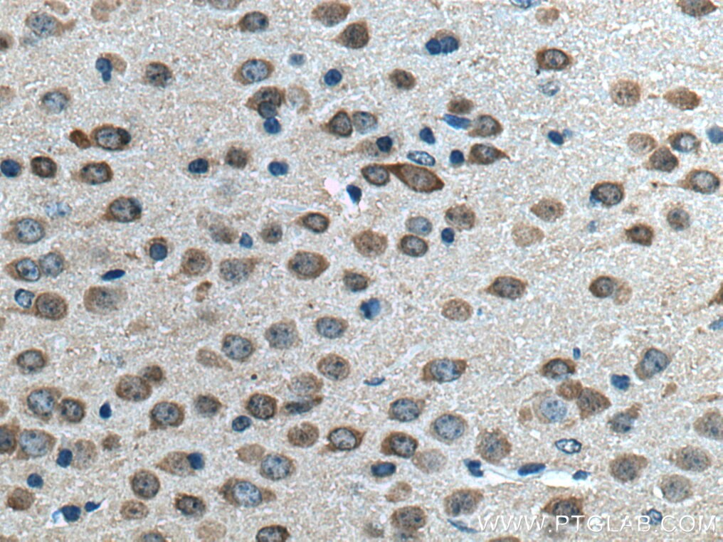 Immunohistochemistry (IHC) staining of mouse brain tissue using CPLX2 Monoclonal antibody (66849-1-Ig)