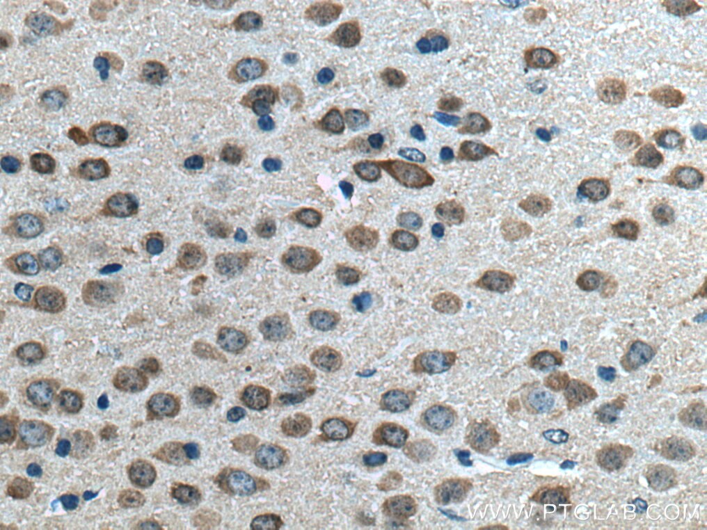 IHC staining of mouse brain using 66849-1-Ig