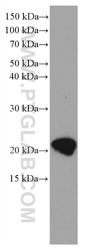 Western Blot (WB) analysis of rat brain tissue using CPLX2 Monoclonal antibody (66849-1-Ig)
