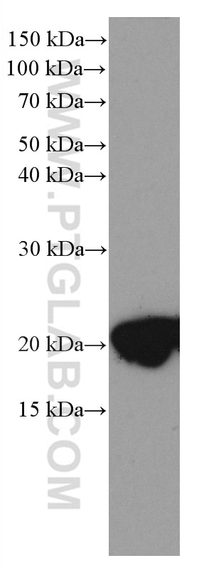 Western Blot (WB) analysis of mouse brain tissue using CPLX2 Monoclonal antibody (66849-1-Ig)